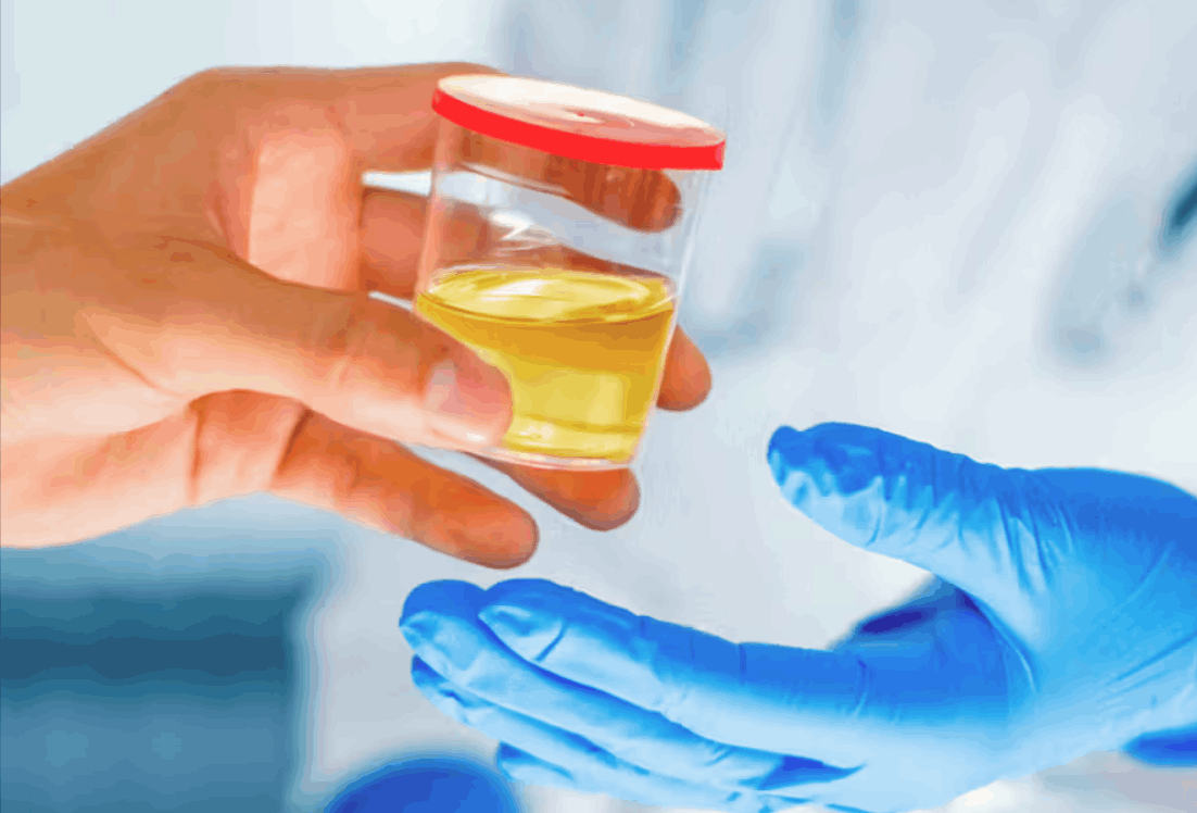 urine collection for DOT drug test